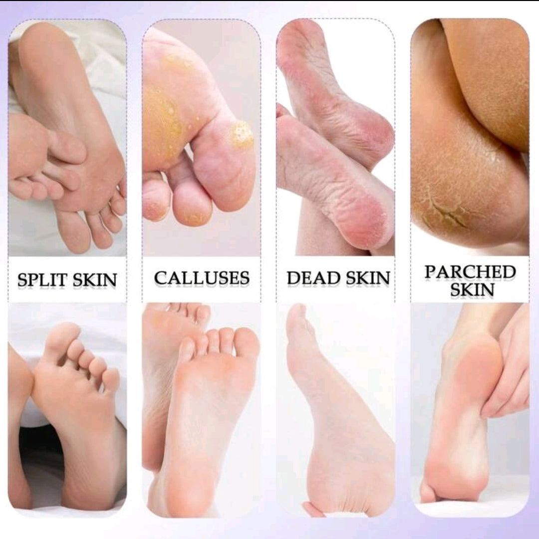 10pcs Foot Care Tool Set